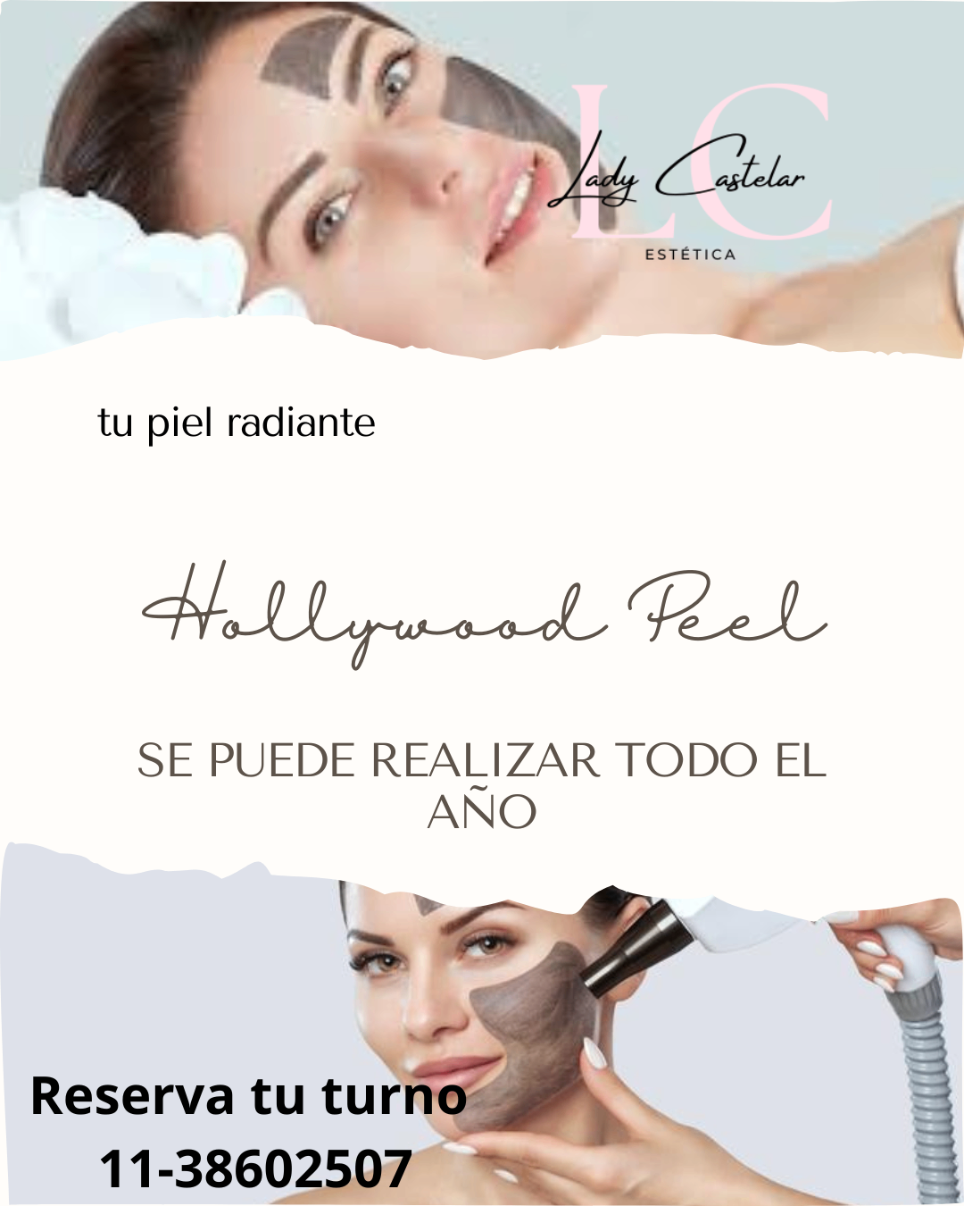 Hollywood peel